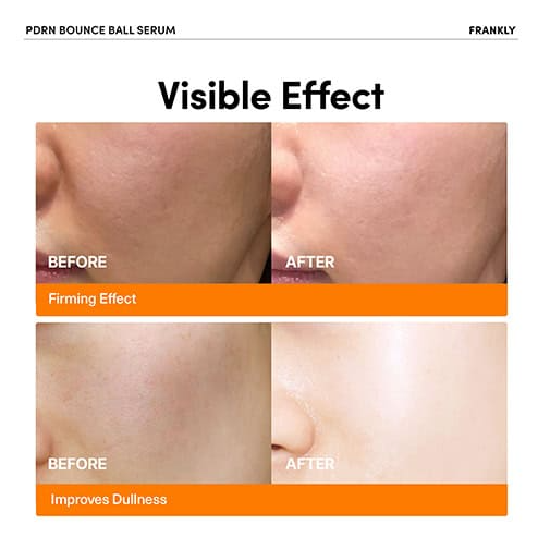 Frankly PDRN Bounce Ball Serum-rozjasňující omlazující sérum 30ml (22)